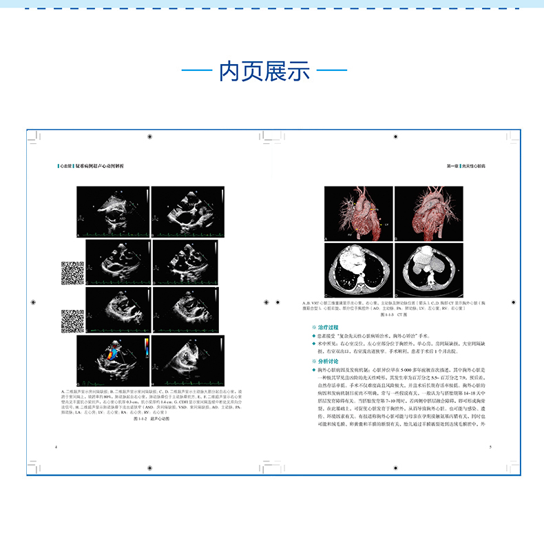 心血管疑难病例超声心动图解析