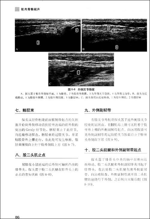 肌肉骨骼超声