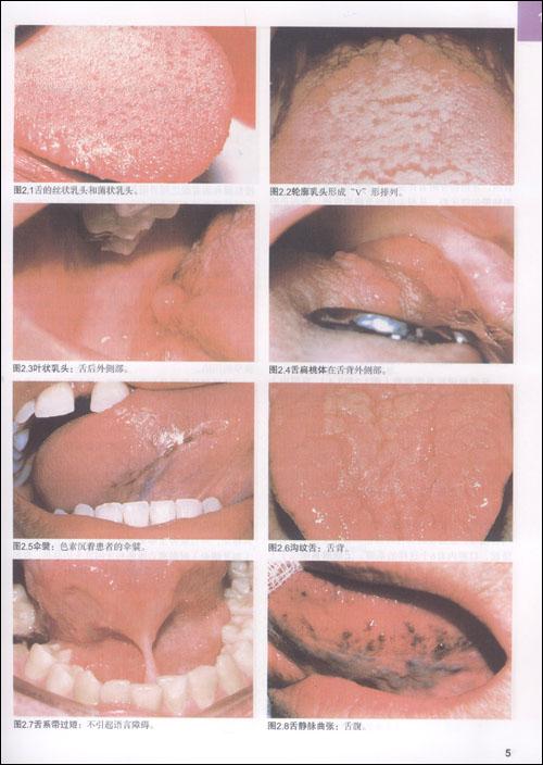 口腔常见疾病彩色图谱