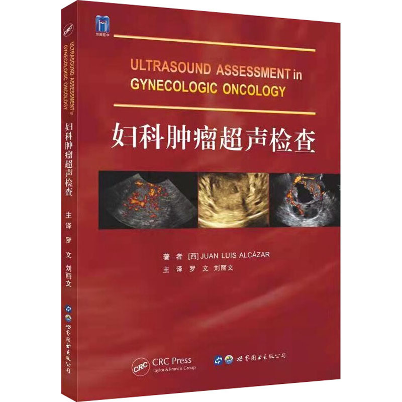  妇科肿瘤超声检查 