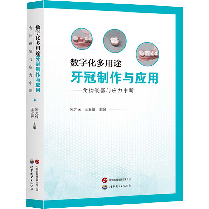  数字化多用途牙冠制作与应用——食物嵌塞与应力中断 