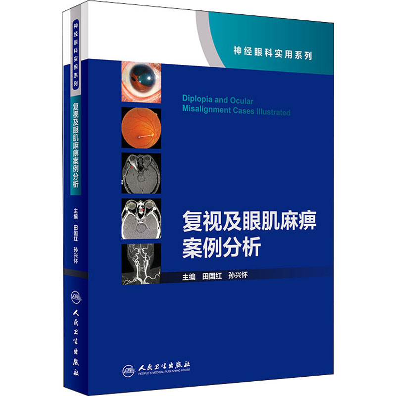  复视及眼肌麻痹案例分析 