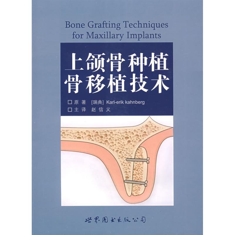  上颌骨种植骨移植技术 